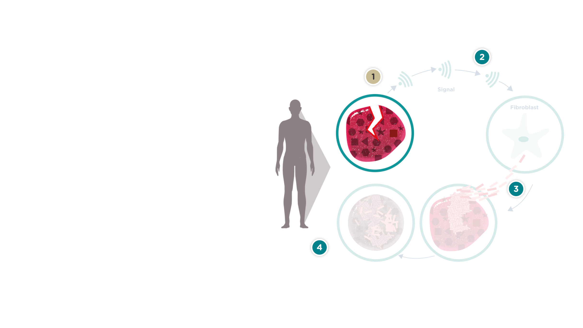 Helingscyklus ved sklerodermi
