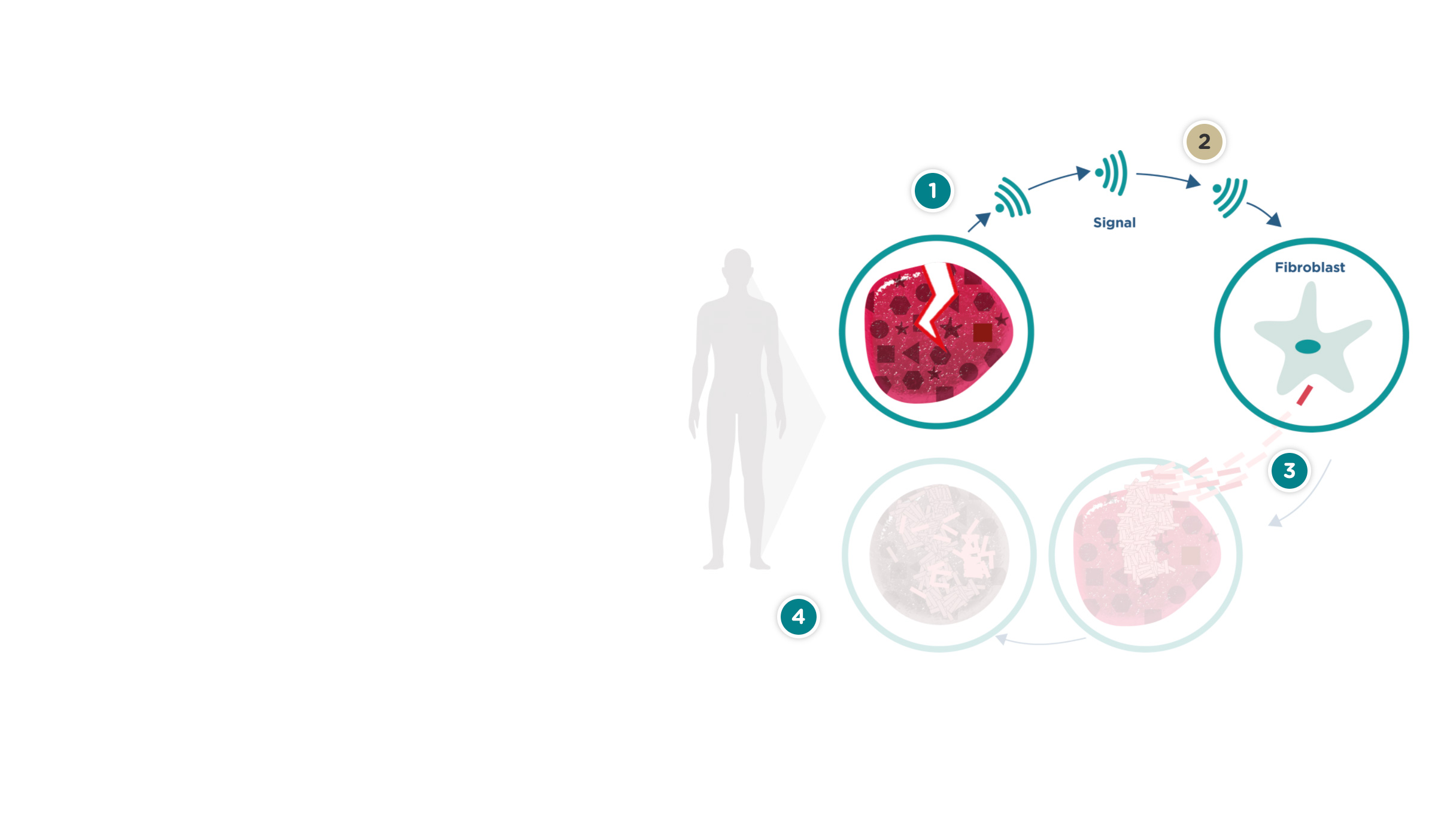 Helingscyklus ved sklerodermi