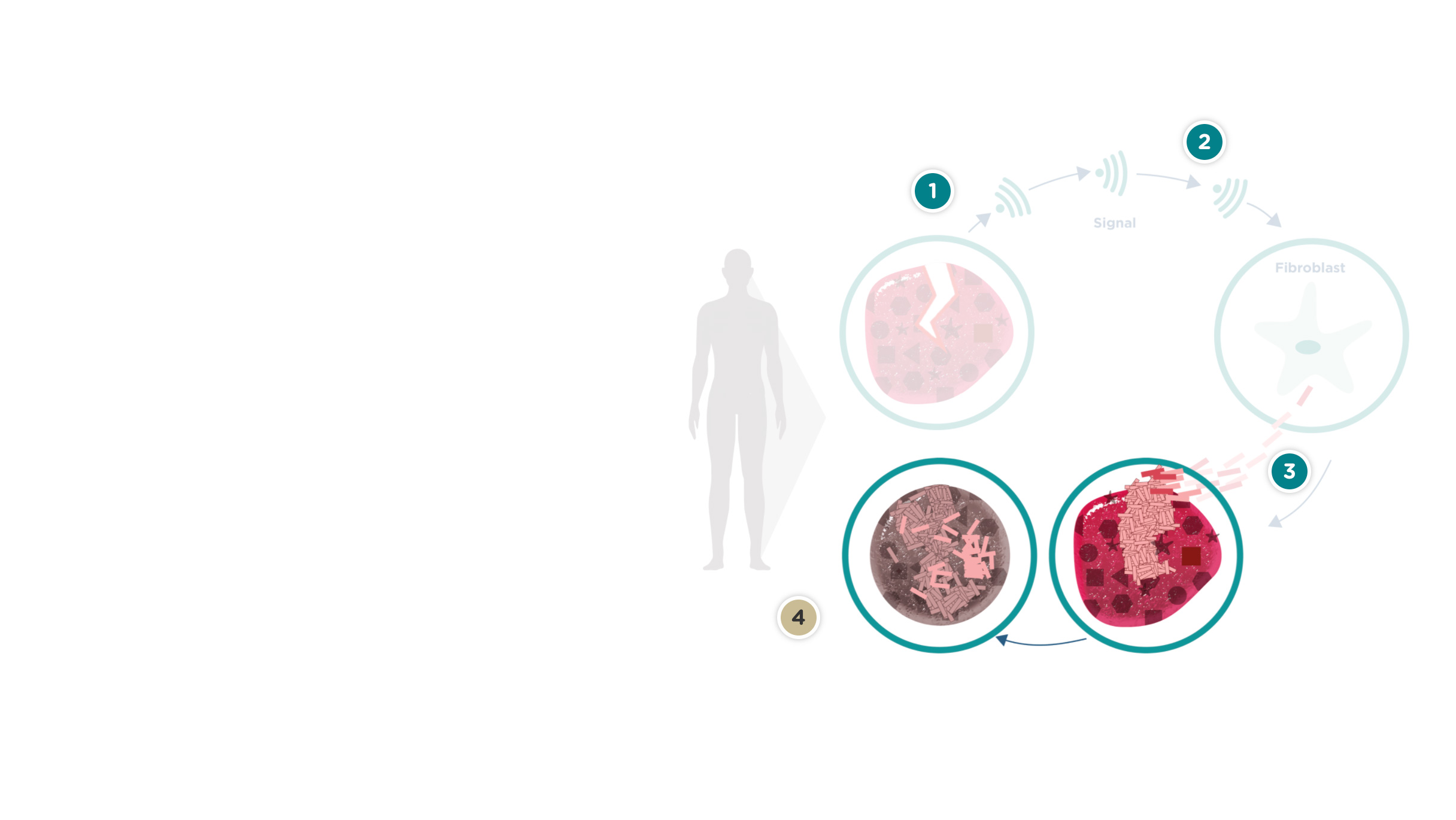 Helingscyklus ved sklerodermi