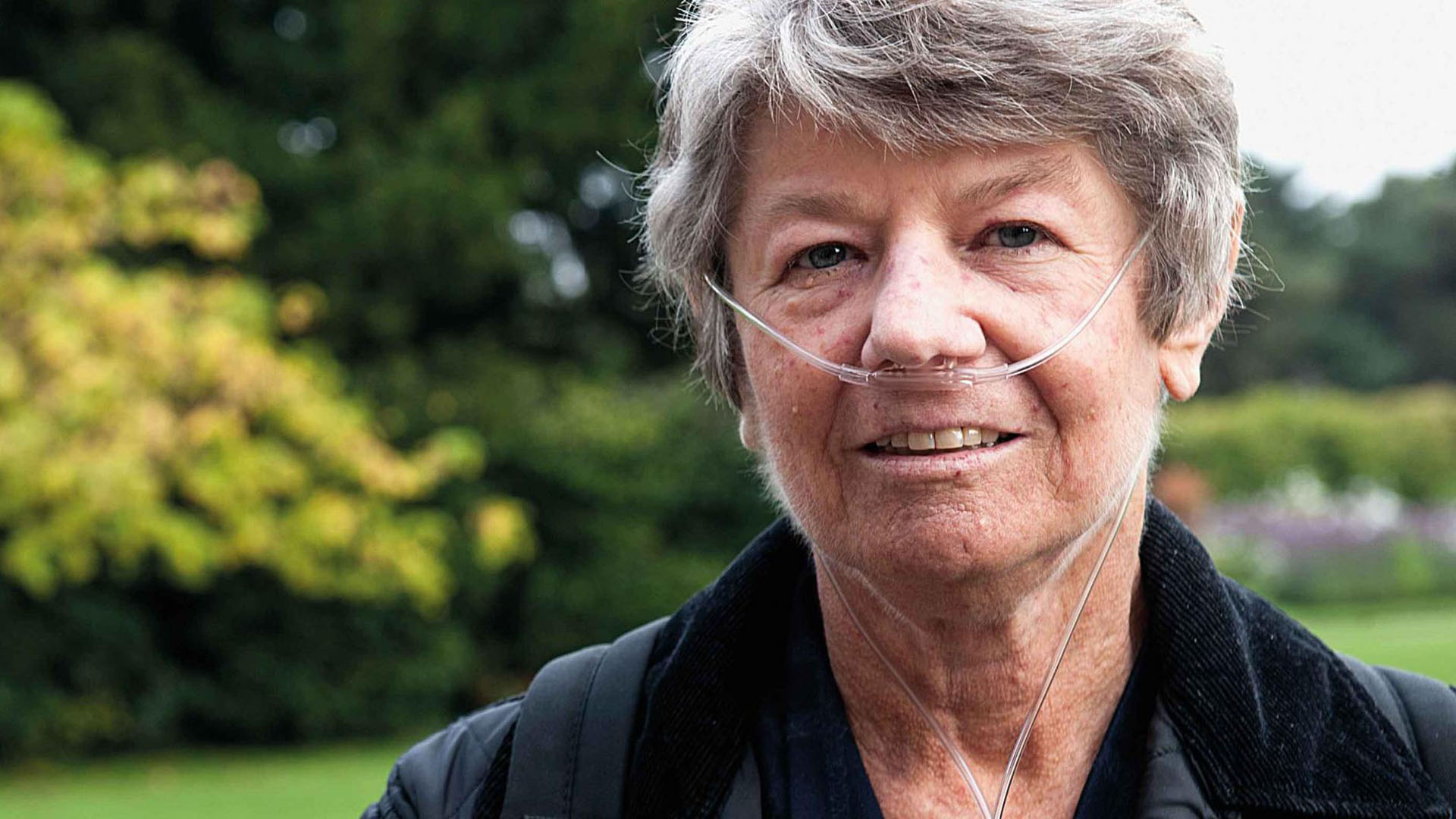 Sklerodermi og lungerne