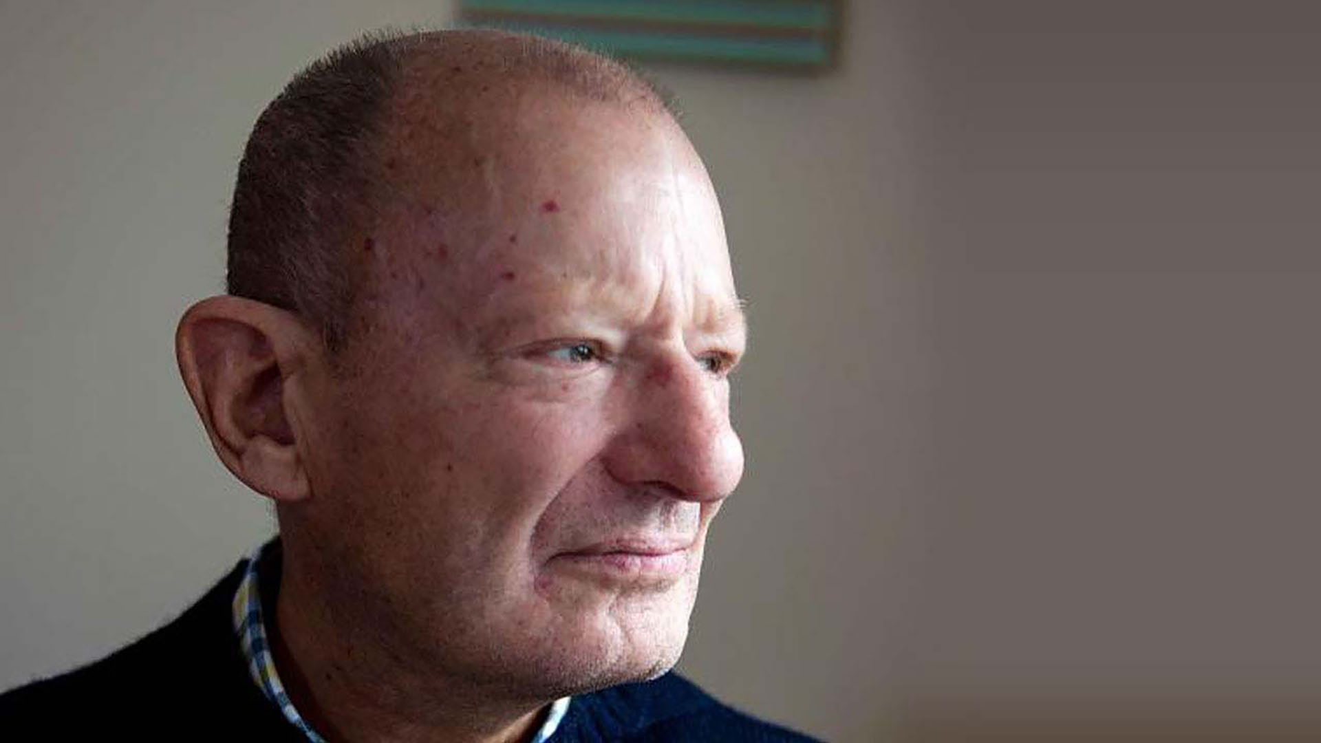 Røde pletter(telangiektasie)