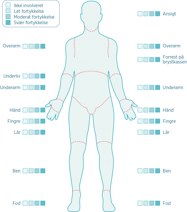 Diagram over måling af sværhedsgraden af en persons hudsymptomer ved sklerodermi