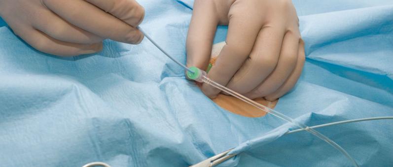 Højresidig hjertekateterisation